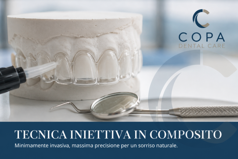 Tecnica iniettiva in composito per migliorare il sorriso con approccio minimamente invasivo presso Copa Dental Care a Casoria